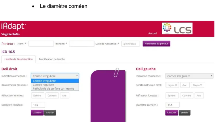 Figure 18 : Logiciel iAdapt de LCS - guide d’adaptation ICD, laboratoire LCS 