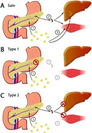 Figure 3 : Différence entre les deux types de diabète 