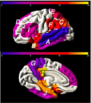 Figure 4. Régions ALZ; A-Gyrus temporal inférieur; B-Pôle temporal; C-Gyrus  angulaire;  D-Gyrus  frontal  supérieur;  E-Lobule  pariétal  supérieur;  F-Gyrus  supramarginal;  G-Précuneus;  H-Cortex  cingulaire  postérieur;  I-Gyrus  frontal  inférieur; J-