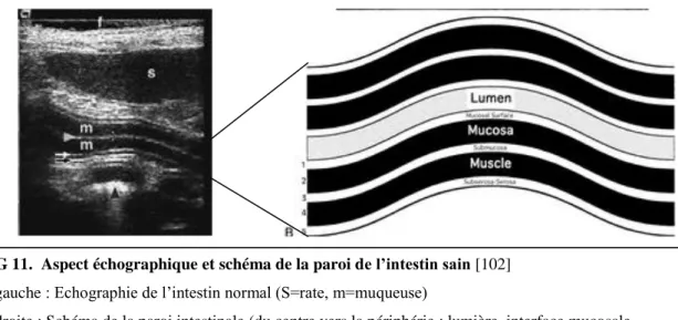 FIG 11.  Aspect échographique et schéma de la paroi de l’intestin sain [102] 