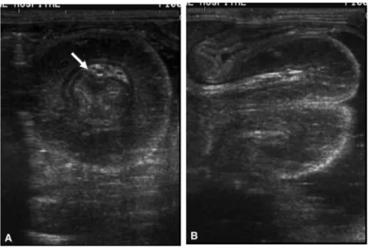 FIG 27.  Aspect échographique d’une intussusception pyloro-gastrique   avec résolution spontanée chez un chien [70] 