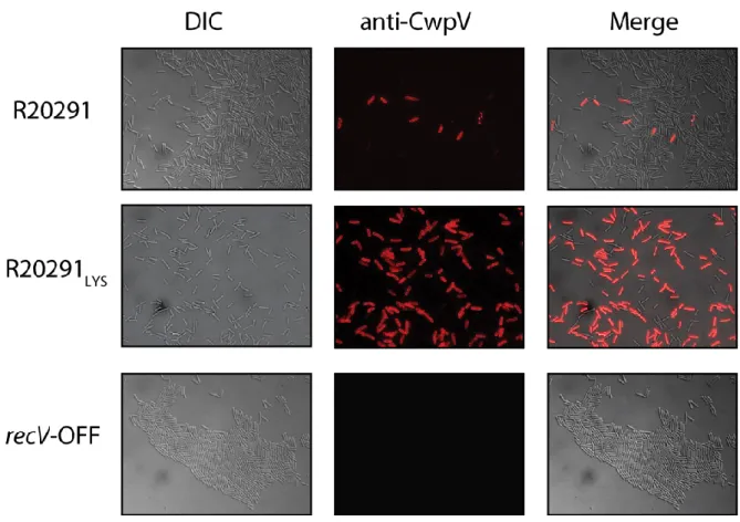 Figure 4. Immunofluorescence detection of CwpV-expressing cells. Culture samples from  the  R20291,  the  R20291 LYS ,  and  the  recV-OFF  strains  were  analyzed  by  light  and  fluorescence  microscopy