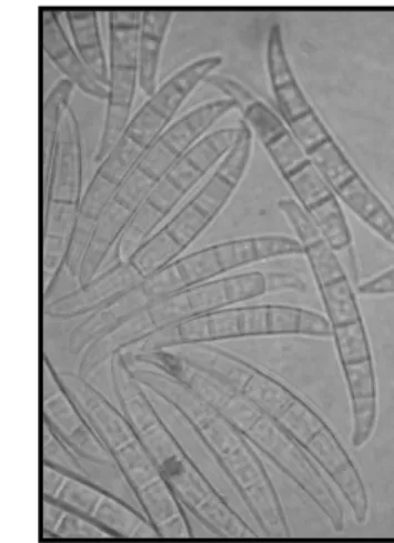 Figure 1: Systematic of Fusarium species  Figure 2: Conidia (F. graminearum)*  Figure 3: Ascospores &amp; Perithecium    (F