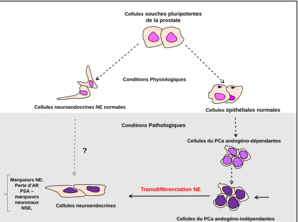 Figure 1.3 – Modèle schématique de la transdifférenciation neuroendocrine dans la progression tumorale de la prostate