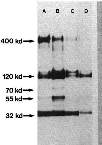 Figure 8 : Analyse des antigènes TES par SDS PAGES. Profil obtenu à partir d'une culture vieillie  de larves(A), après 1 semaine de culture (B), après 2 semaines de culture (C), profil obtenu après  traitement des Ag TES par l'iode (D) 