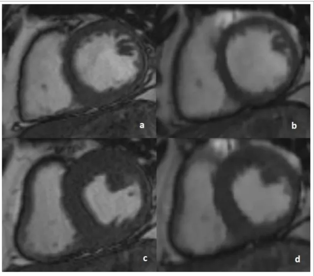 Figure 2: Midventricular short-axis views 