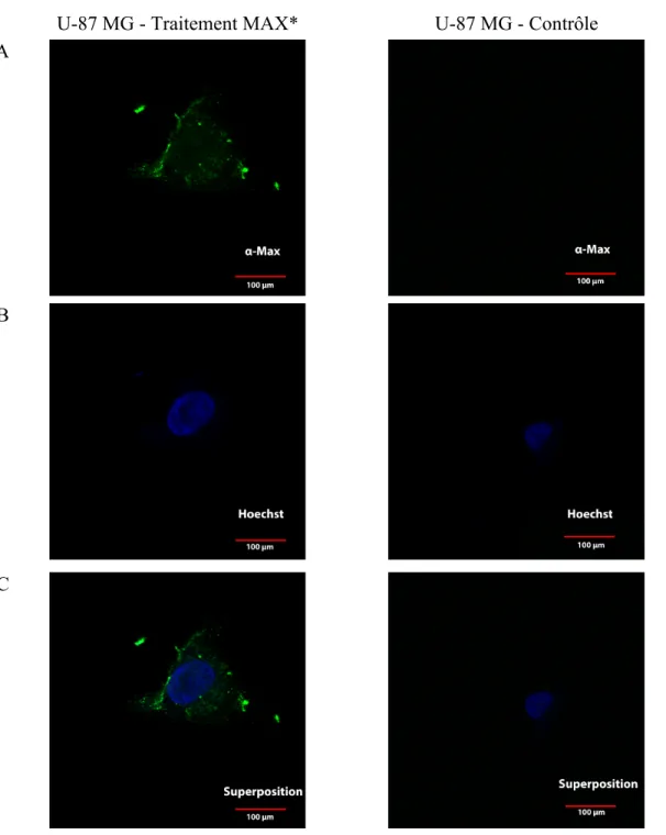 Figure  9  : Image par microscopie confocale de cellules U-87  MG traitées ou non avec  MAX* à concentration de 20 µM pour une période de 1 heure