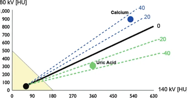 Figure 2 :  Décomposition en trois matériaux (acide urique, tissus mous, et calcium)  grâce à l’algorithme de scanner DECT
