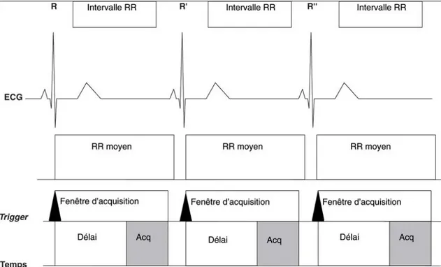 Figure  6  :  Illustration  de  l’acquisition  IRM  en  mode  prospectif.  L'acquisition  est  déclenchée par la détection automatique de l’onde R sur l‘ECG  30 