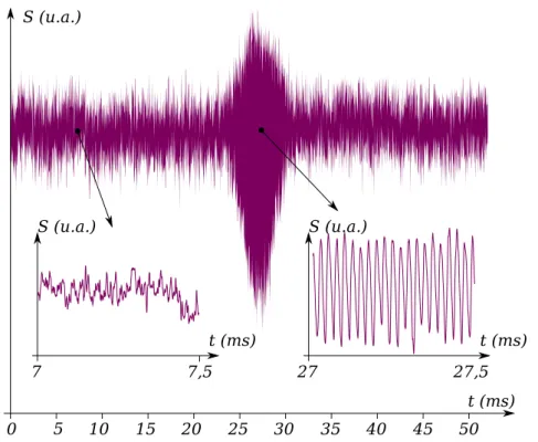 Figure 1.13 – Puissance du laser S lors du passage d’une particule dans le faisceau.