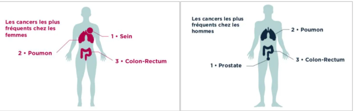 Figure 6: Les cancers les plus fréquents chez les femmes et chez les hommes, L’engagement  du Leem contre le cancer, nos 15 objectifs, 2018 