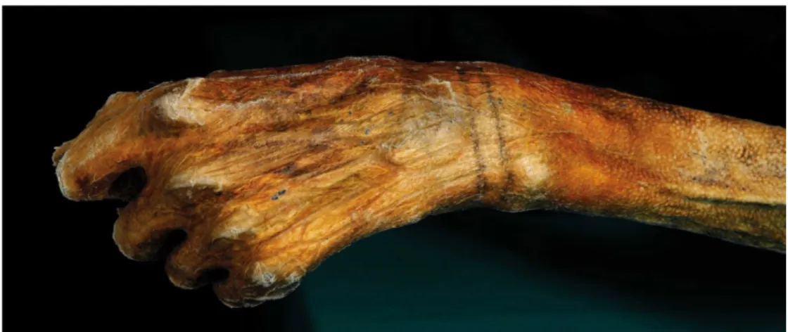 Figure 1 : bras d'Ötzi  (5)
