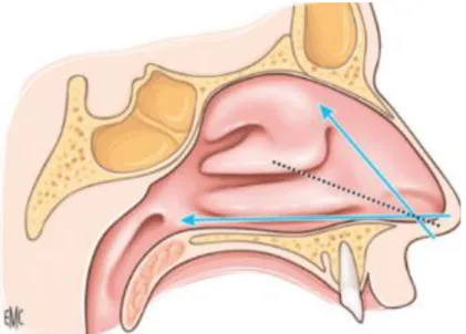 Figure 6 :  EMC Physiologie nasale. Grossièrement, le flux aérien nasal suit un trajet formé  par la bissectrice entre l’axe de l’auvent nasal et celui du plancher de la fosse nasale