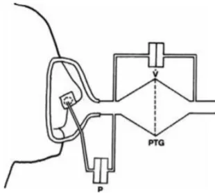 Figure 12 Principes de la rhinomanométrie active antérieure. Mise en place d’un capteur de  pression dans la cavité nasale non évaluée