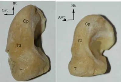 Figure 3 : Vue antérieure (à gauche) et médiale (à droite) d’un scaphoïde droit : Cp = corps, Cl =  col, T : tubercule, d’après (4)