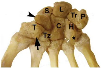 Figure 1 : Vue antérieure des os du carpe sur pièce anatomique d’après (4). Trapèze (T), 