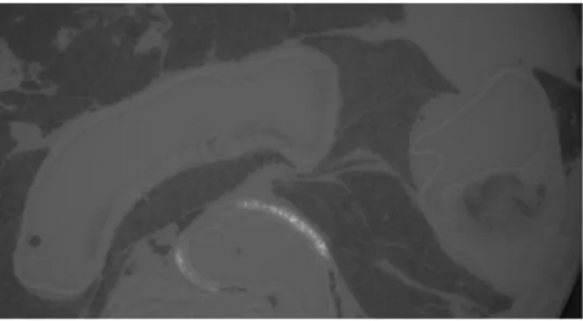 Figure 4 Two-dimensional section of an ApoE(-/-) aortic arch obtained by computed tomography