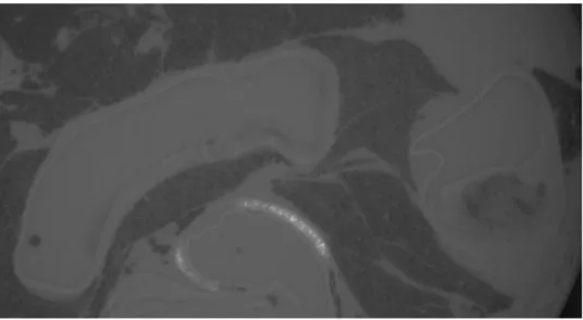 Figure 4 Two-dimensional section of an ApoE(-/-) aortic arch obtained by computed tomography