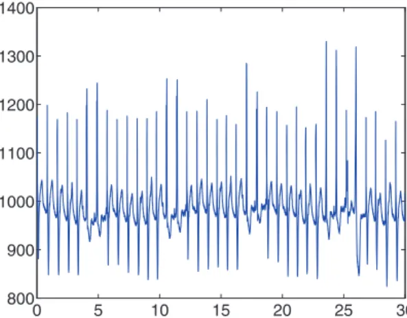 Fig. 1. ECG recording of a subject showing evidence of significant arrhythmia (30 first seconds of patient Sel104 from the QT database).