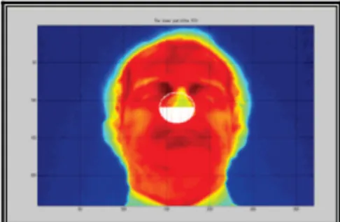 Figure 2.4 Placement automatique de la ROI [Al-Khalidi et al., 2010].