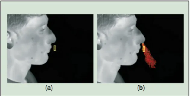 Figure 2.5 Visualisation de la phase d’expiration par le nez ou la bouche et de la ROI associée (sujet de proﬁl) [Murthy et Pavlidis, 2006].