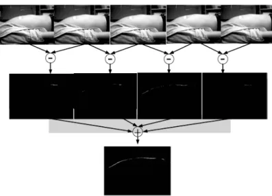 Figure 2.9 Mesure des mouvements du thorax pour un sujet en position cou- cou-chée [Bai et al., 2010a,b].