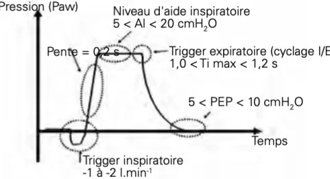 Figure 8 : Principaux éléments à régler lors d'un aide inspiratoire(30)