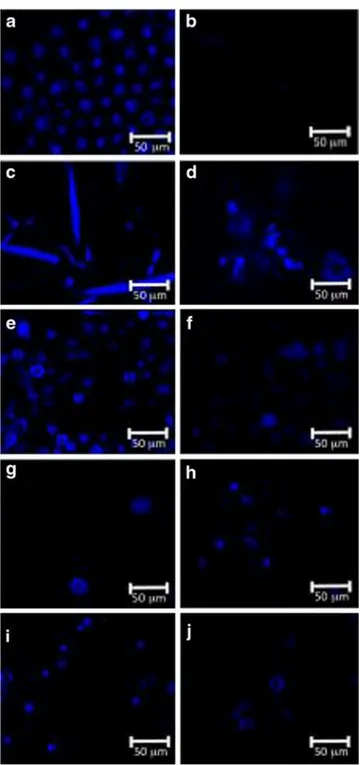 Fig.  1  Laser  scanning confocal microscopie observation before  (left)  and  after  (right)  alkaline  treatment  for  each  microalga