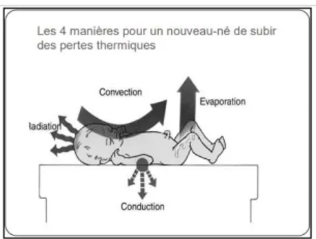 Figure 3 : Schématisation des pertes thermiques pour un nouveau-né.