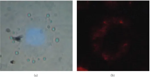 Figure 11: Internalization of mSiO 2 -Eu(TTA) 3 (Phen-Si) in MDA-MB231 cancer cells after exposure to NPs (overnight, 0.1 mg⋅mL −1 )