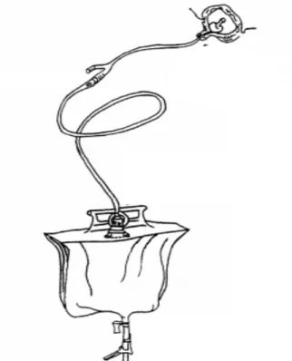 Figure 4 : Système pré-connecté  3.2.1.1.  La longueur  