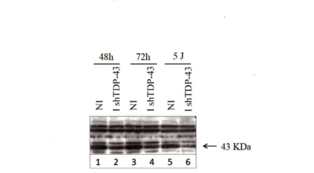 Figure  3 :  Visualisation  du  mveau  d'expression  protéique  de  TDP-43  par  immunobuvardage  de  type  western