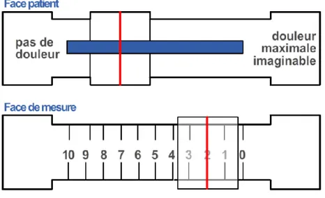 Figure 2 : Exemple d'échelle visuelle analogique [18]  