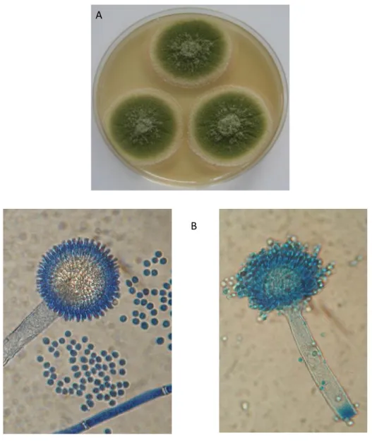 Figure 4 : Aspergillus flavus 