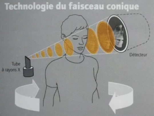 Figure 2: «Géométrie du faisceau conique d’un système Tomographie Volumique à  Faisceau Conique dentaire» (25) 