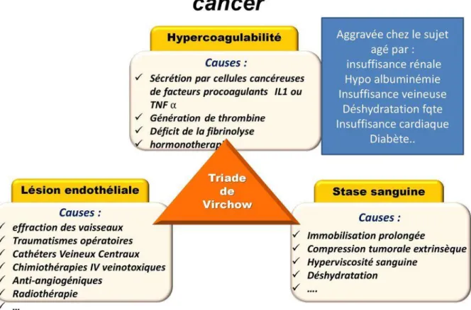 Figure 5 - La Triade de VIRCHOW appliquée au cancer