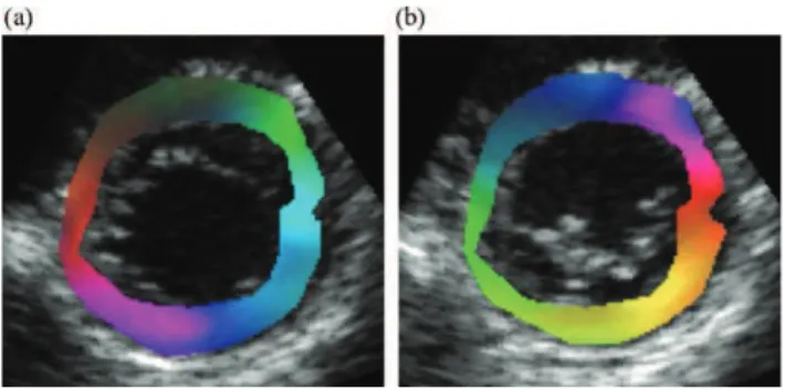 Fig. 2. Frames from a synthetic short-axis sequence during ventricular filling (diastole) (a) and ventricular ejection (systole) (b)
