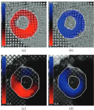 Fig. 7. Color encoding of the radial component of the estimated displacement.