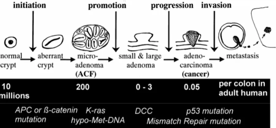 Figure 4 : Evolution multiphasique d’une crypte normale en adénocarcinome, et mutations associées à  chaque étape 