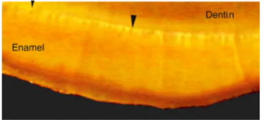 Figure 3 : Coupe montrant les « tufts » au niveau de la JAD  [12] 