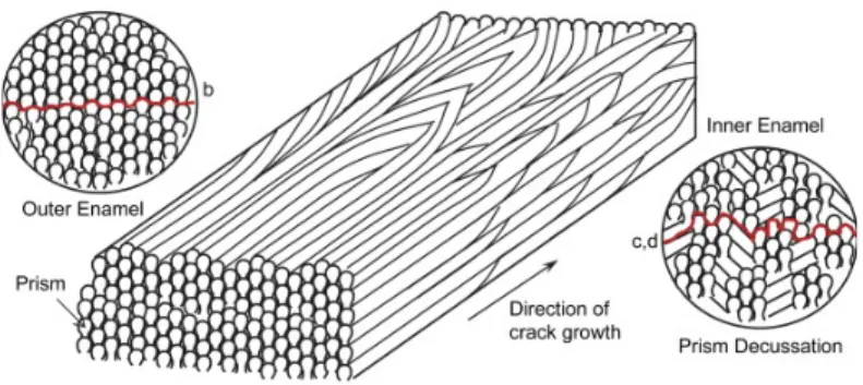 Figure 11 : Schéma de progression de la fêlure dans l'émail externe et interne [7] 