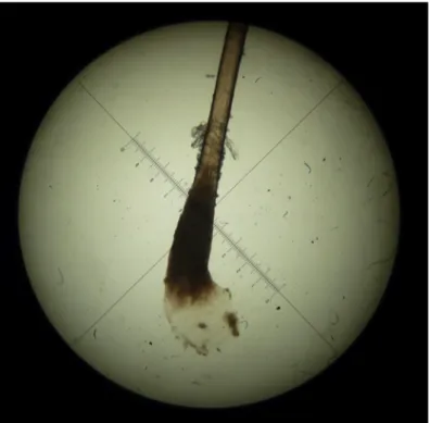 Figure 5: Schéma de la racine d'un cheveu vu au microscope