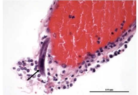 Figure 14 : Coupe histologique, tronc cérébral (Eydal et al.) : infiltrat composé de lymphocytes,  macrophages et plasmocytes autour d'un vaisseau sanguin et section longitudinale d'un nématode (flèche) 