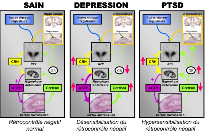 Figure 3 : Altérations de l’axe corticotrope dans la dépression et le PTSD (d’après Yehuda, 2002)