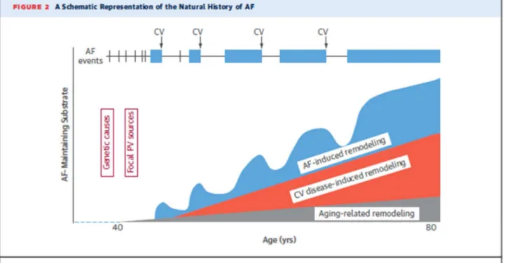 Figure 3 : illustration de l’histoire naturelle de la cardiomyopathie atriale proposée  par Guichard et Nattel en 2017 (23)