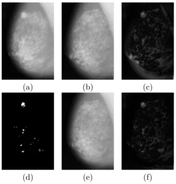 Figure 5.4. Images (a) and (b) form a pair of bilateral mammograms of a same woman. Image (c) is the difference between images (a) and (b) before registration