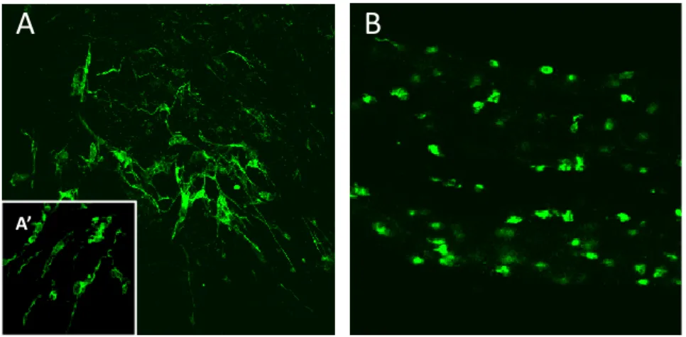 Figure  12:  Immunodétection  de  la  microglie  par  la  gliarine  dans  des  fragments  de  SNC