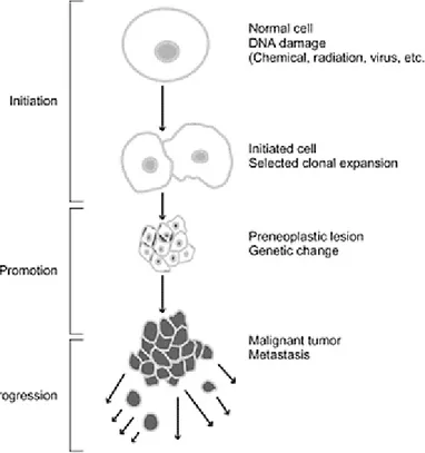 Figure 6 :  Les  trois  étapes  du  développement  tumoral :  initiation,  promotion,  progression  (D’après H