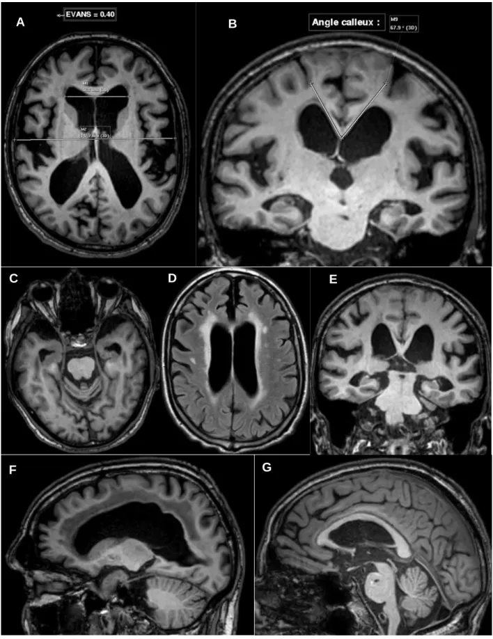Figure 7 : Illustration des différents biomarqueurs 2D en imagerie.  