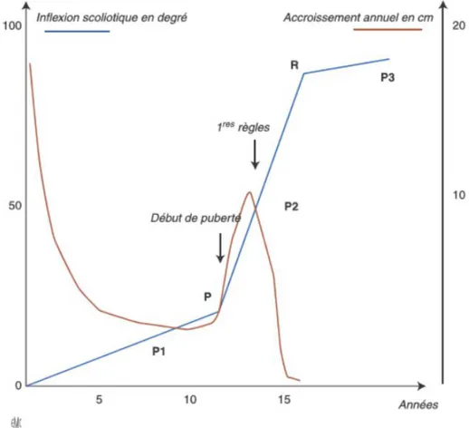 Figure 5 - Courbe de Duval-Beaupère tiré de Bin et al (4) P pour pente, R pour Risser 4 